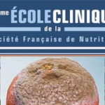 « Les polluants et l’alimentation », 3ème École clinique de la SFN
